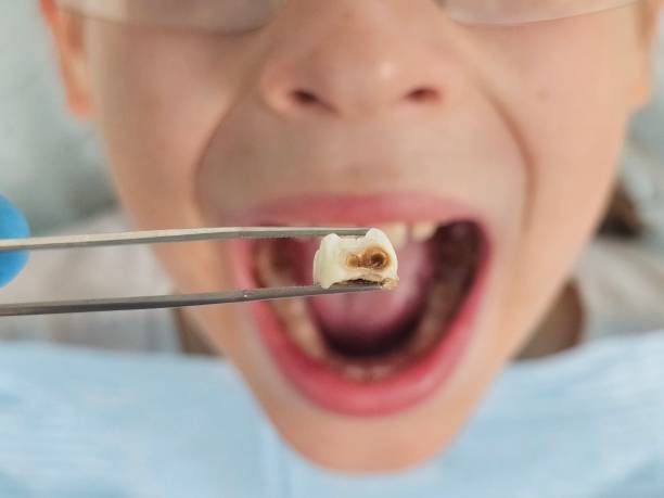 Best Urgent Dental Care in Vla Grove, IL