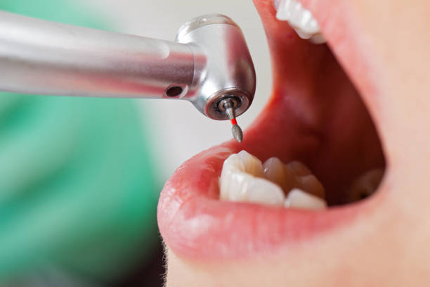Best Pediatric Emergency Dentist in Vla Grove, IL